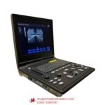 Oriel Notebook Premium Ultrasound Machine (1-Year Repairing Warranty from Brand)