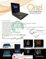 Oriel Notebook Premium Ultrasound Machine (1-Year Repairing Warranty from Brand) - Image 4