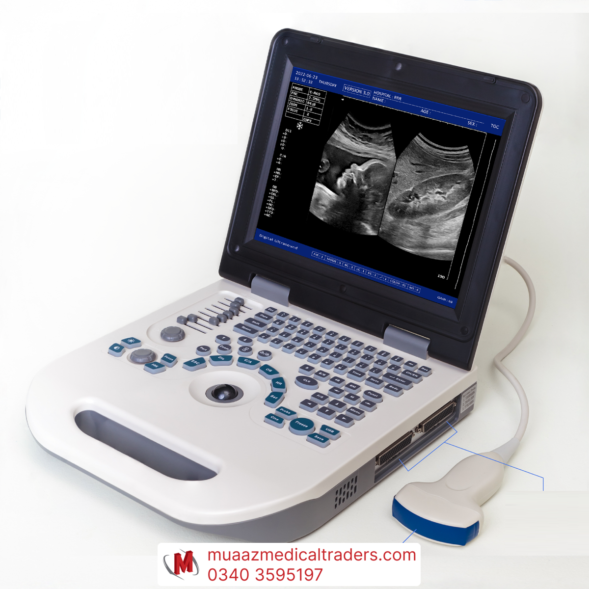 671_0_Nyro-10-A-2-copy-1-1 NYRO 10 Portable Ultrasound Machine (1-Year Repairing Warranty from Brand) - Image 1